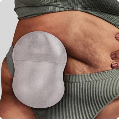A closeup shot of a woman using an 8-shaped ostomy pouch with Leak Defense™.